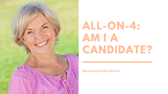 All-On-4 Dental Implants: Am I a Candidate?