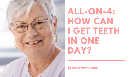 All-On-4 Dental Implants: How Can I Get My Teeth In One Day?