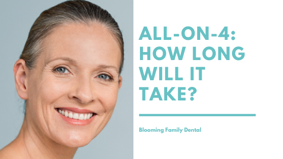 All-On-4 Dental Implants: How Long Will It Take?