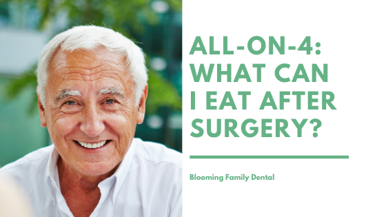 All-On-4 Dental Implants: What Can I Eat After Surgery?
