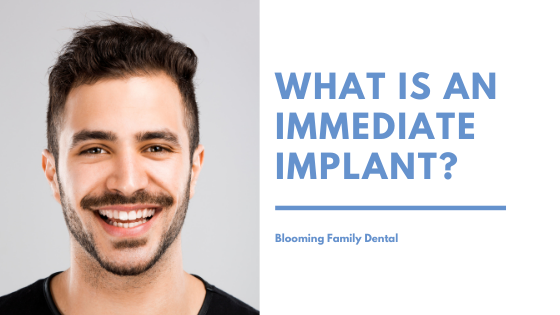 What is an Immediate Implant?